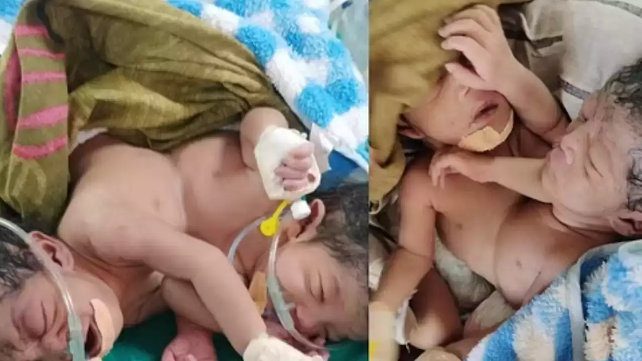  Twin girls born in ambala